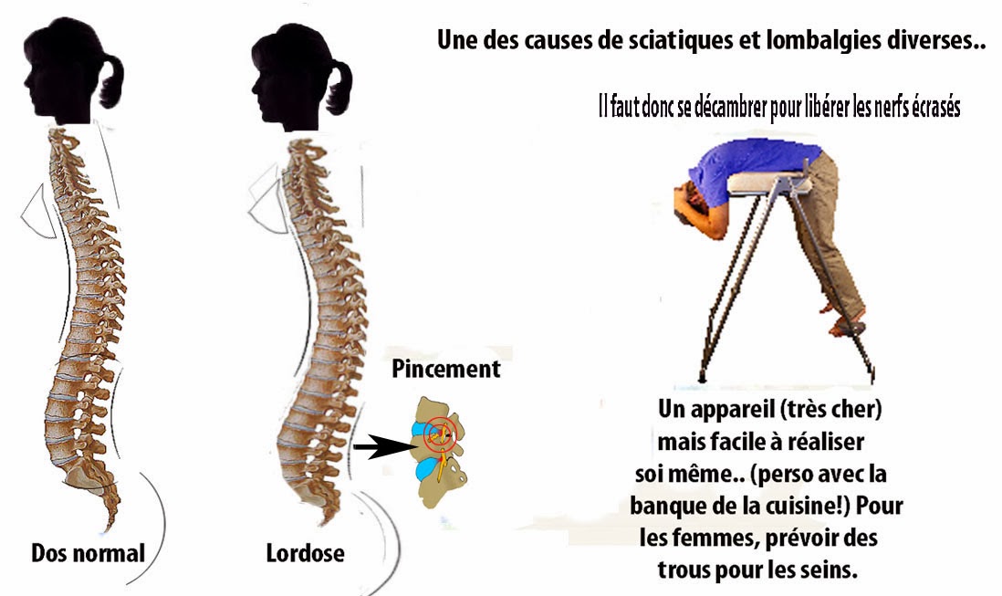 Médicamentaire le traitement osteokhondroza